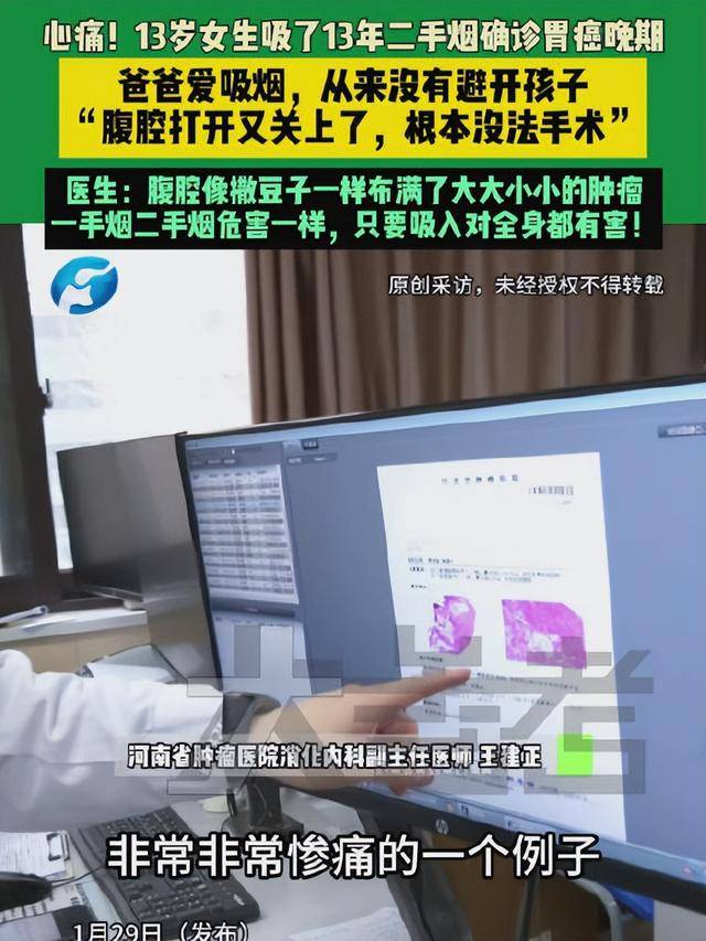 正版皇冠信用网出租_爸爸常年在家吸烟正版皇冠信用网出租，13岁女儿吸13年二手烟腹腔内长满肿瘤